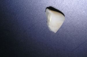 Fragment zuba